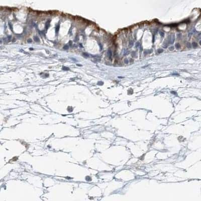 Immunohistochemistry-Paraffin: DNAH5 Antibody [NBP1-84464] - Staining of human nasopharynx.