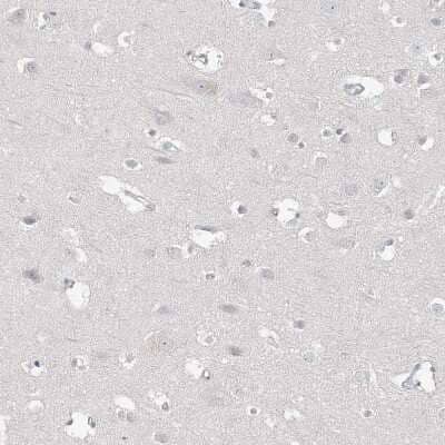 Immunohistochemistry-Paraffin: DNAH5 Antibody [NBP1-84464] - Staining of human cerebral cortex shows no positivity in neurons as expected.