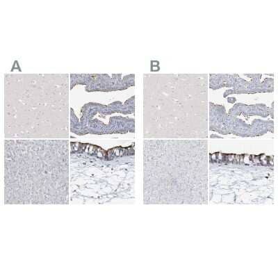 <b>Independent Antibodies Validation. </b>Immunohistochemistry-Paraffin: DNAH5 Antibody [NBP1-84464] - Staining of human cerebral cortex, fallopian tube, liver and nasopharynx using Anti-DNAH5 antibody NBP1-84464 (A) shows similar protein distribution across tissues to independent antibody NBP1-84463 (B).