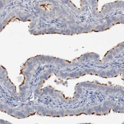 Immunohistochemistry-Paraffin: DNAH5 Antibody [NBP1-84464] - Staining of human Fallopian tube shows strong positivity in cilia in glandular cells.