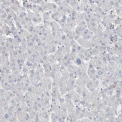 Immunohistochemistry-Paraffin: DNAH5 Antibody [NBP1-84464] - Staining of human liver shows no positivity in hepatocytes as expected.