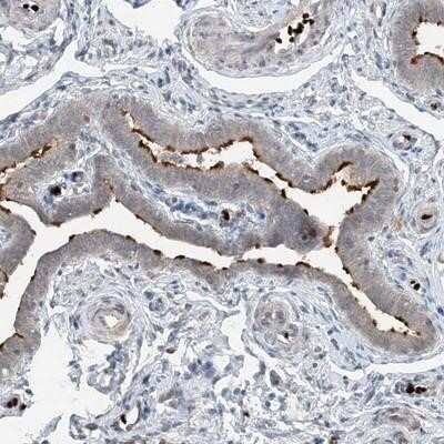 Immunohistochemistry-Paraffin: DNAH7 Antibody [NBP1-93613] - Staining of human fallopian tube shows positivity in cilia.