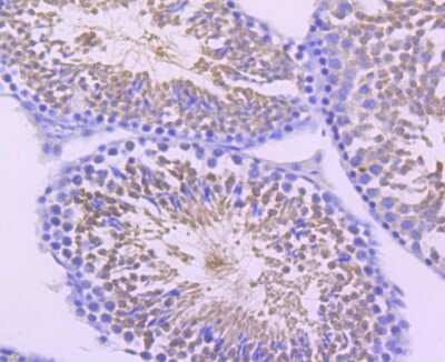 Immunohistochemistry-Paraffin: DNAI1 Antibody (JM11-38) [NBP2-66804] - Analysis of paraffin-embedded mouse testes tissue using anti-Dynein intermediate chain 1 antibody. Counter stained with hematoxylin.
