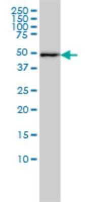 Western Blot: DNAJA2 Antibody (2A11-F2) [H00010294-M01] - DNAJA2 monoclonal antibody (M01), clone 2A11-F2 Analysis of DNAJA2 expression in A-431.