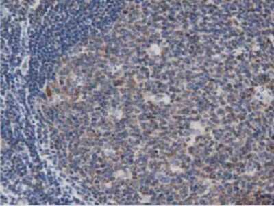 Immunohistochemistry-Paraffin: DNAJA2 Antibody (3A10) [NBP2-02996] - Staining of paraffin-embedded Human lymph node tissue using anti-DNAJA2 mouse monoclonal antibody.