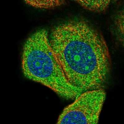 Immunocytochemistry/Immunofluorescence: DNAJA2 Antibody [NBP2-57134] - Staining of human cell line MCF7 shows localization to nucleoli & cytosol. Antibody staining is shown in green.