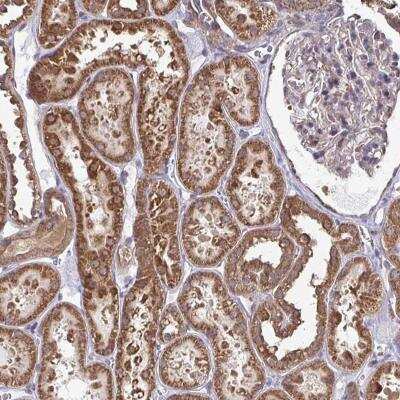 Immunohistochemistry-Paraffin: DNAJA2 Antibody [NBP2-32551] - Staining of human kidney shows strong cytoplasmic positivity in renal tubules.