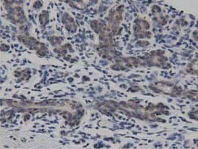 Immunohistochemistry: DNAJA2 Antibody (OTI3A10) - Azide and BSA Free [NBP2-71565] - Staining of paraffin-embedded Human breast tissue using anti-DNAJA2 mouse monoclonal antibody.