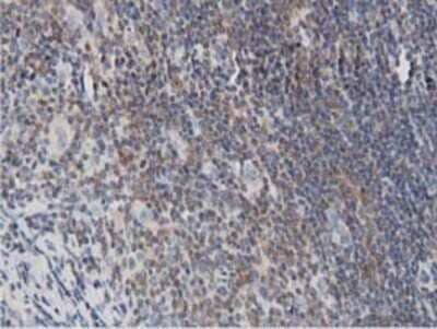 Immunohistochemistry: DNAJA2 Antibody (OTI3A10) - Azide and BSA Free [NBP2-71565] - Staining of paraffin-embedded Human lymphoma tissue using anti-DNAJA2 mouse monoclonal antibody.