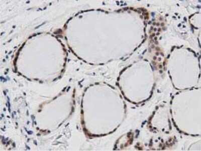 Immunohistochemistry: DNAJA2 Antibody (OTI3A10) - Azide and BSA Free [NBP2-71565] - Staining of paraffin-embedded Human thyroid tissue using anti-DNAJA2 mouse monoclonal antibody.