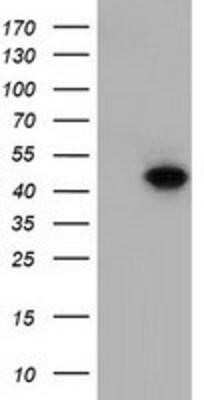 Western Blot: DNAJA2 Antibody (OTI3A10) - Azide and BSA Free [NBP2-71565] - HEK293T cells were transfected with the pCMV6-ENTRY control (Left lane) or pCMV6-ENTRY DNAJA2 (Right lane) cDNA for 48 hrs and lysed. Equivalent amounts of cell lysates (5 ug per lane) were separated by SDS-PAGE and immunoblotted with anti-DNAJA2.