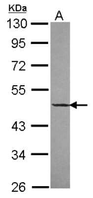 Western Blot: DNAJA2 Antibody [NBP2-16190] - Sample (30 ug of whole cell lysate) A: A431 10% SDS PAGE gel, diluted at 1:500.