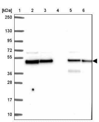 Western Blot: DNAJA2 Antibody [NBP2-32551] - Lane 1: Marker  [kDa] 250, 130, 95, 72, 55, 36, 28, 17, 10.  Lane 2: Human cell line RT-4.  Lane 3: Human cell line U-251MG sp.  Lane 4: Human plasma (IgG/HSA depleted).  Lane 5: Human liver tissue.  Lane 6: Human tonsil tissue