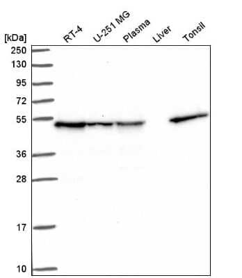 Western Blot: DNAJA2 Antibody [NBP2-57134] - Analysis in human cell line RT-4, human cell line U-251 MG, human plasma, human liver tissue and human tonsil tissue.