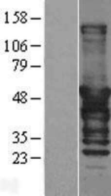 Western Blot: DNAJA2 Overexpression Lysate (Adult Normal) [NBL1-09930] Left-Empty vector transfected control cell lysate (HEK293 cell lysate); Right -Over-expression Lysate for DNAJA2.