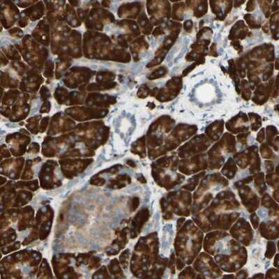 Immunohistochemistry-Paraffin DNAJB11 Antibody