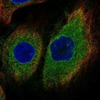 Immunocytochemistry/Immunofluorescence: DNAJB12 Antibody [NBP3-17700] - Staining of human cell line HaCaT shows localization to nuclear membrane & endoplasmic reticulum.