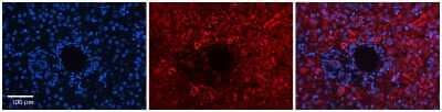 Immunohistochemistry: DNAJB12 Antibody [NBP1-59444] - Formalin Fixed Paraffin Embedded Tissue: Human Liver Tissue Observed Staining: Cytoplasm in hepatocytes Primary Antibody Concentration: 1:100 Other Working Concentrations: 1:600 Secondary Antibody: Donkey anti-Rabbit-Cy3 Secondary Antibody Concentration: 1:200 Magnification: 20X Exposure Time: 0.5 - 2.0 sec