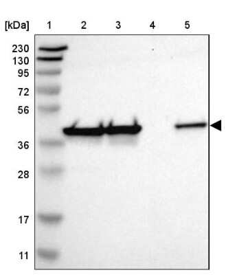Western Blot: DNAJB12 Antibody [NBP1-85208] - Lane 1: Marker  [kDa] 230, 130, 95, 72, 56, 36, 28, 17, 11.  Lane 2: Human cell line RT-4.  Lane 3: Human cell line U-251MG sp.  Lane 4: Human plasma (IgG/HSA depleted).  Lane 5: Human liver tissue