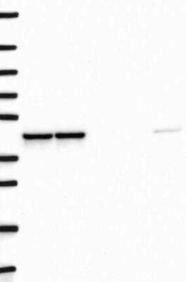 Western Blot: DNAJB12 Antibody [NBP3-17700] - Lane 1: Marker [kDa] 250, 130, 95, 72, 55, 36, 28, 17, 10;   Lane 2: RT4;   Lane 3: U-251 MG;   Lane 4: Human Plasma;   Lane 5: Liver;   Lane 6: Tonsil