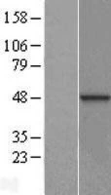 Western Blot: DNAJB12 Overexpression Lysate (Adult Normal) [NBL1-09934] Left-Empty vector transfected control cell lysate (HEK293 cell lysate); Right -Over-expression Lysate for DNAJB12.