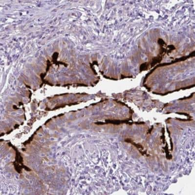 Immunohistochemistry: DNAJB13 Antibody [NBP2-30620] - Staining of human bronchus shows strong membranous with additional cytoplasmic positivity in respiratory epithelial cells.