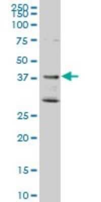 Western Blot: DNAJB2 Antibody (1B7) [H00003300-M02] - DNAJB2 monoclonal antibody (M02), clone 1B7. Analysis of DNAJB2 expression in A-431.