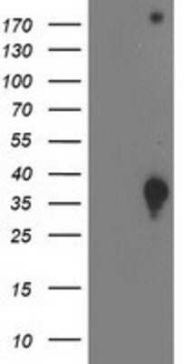 Western Blot DNAJB2 Antibody (OTI4D12)