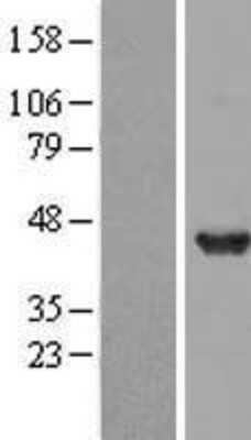 Western Blot: DNAJB2 Overexpression Lysate (Adult Normal) [NBL1-09936] Left-Empty vector transfected control cell lysate (HEK293 cell lysate); Right -Over-expression Lysate for DNAJB2.