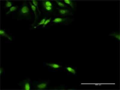 Immunocytochemistry/Immunofluorescence: DNAJB4 Antibody [H00011080-D01P] - Analysis of antibody to DNAJB4 on HeLa cell. Antibody concentration 20 ug/ml.