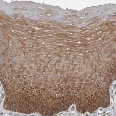 Immunohistochemistry-Paraffin DNAJB4 Antibody