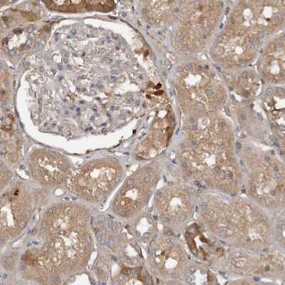 Immunohistochemistry-Paraffin DNAJB4 Antibody