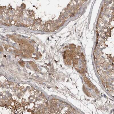 Immunohistochemistry-Paraffin: DNAJB4 Antibody [NBP1-81735] - Staining of human testis shows moderate cytoplasmic positivity in Leydig cells and cells in seminiferous ducts.