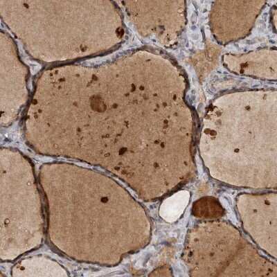 Immunohistochemistry-Paraffin: DNAJB4 Antibody [NBP1-81735] - Staining of human thyroid gland shows strong cytoplasmic positivity in glandular cells.
