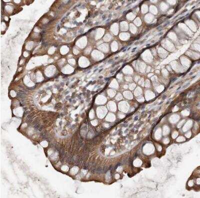 Immunohistochemistry-Paraffin: DNAJB4 Antibody [NBP1-81736] - Staining of human rectum shows moderate positivity in glandular cells