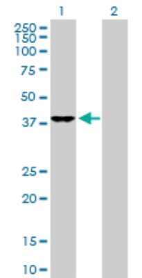 Western Blot: DNAJB4 Antibody [H00011080-D01P] - Analysis of DNAJB4 expression in transfected 293T cell line by DNAJB4 polyclonal antibody.Lane 1: DNAJB4 transfected lysate(37.80 KDa).Lane 2: Non-transfected lysate.