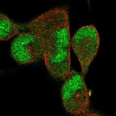 Immunocytochemistry/Immunofluorescence: DNAJB5 Antibody [NBP2-58535] - Staining of human cell line RH-30 shows localization to nucleus & cytosol. Antibody staining is shown in green.