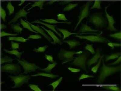 Immunocytochemistry/Immunofluorescence: DNAJB6 Antibody (2D12-B9) [H00010049-M02] - Analysis of monoclonal antibody to DNAJB6 on HeLa cell . Antibody concentration 10 ug/ml.