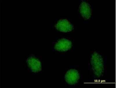 Immunocytochemistry/Immunofluorescence: DNAJB6 Antibody [H00010049-B01P] - Analysis of purified antibody to DNAJB6 on HeLa cell. (antibody concentration 10 ug/ml)