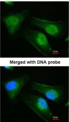 Immunocytochemistry/Immunofluorescence: DNAJB6 Antibody [NBP1-32175] - Paraformaldehyde-fixed HeLa, using antibody at 1:200 dilution.