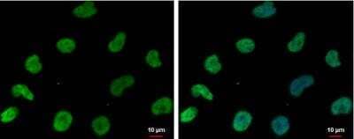 Immunocytochemistry/Immunofluorescence: DNAJB6 Antibody [NBP2-16193] - NT2D1 cells were fixed in 4% paraformaldehyde at RT for 15 min. Green: DNAJB6 protein stained by DNAJB6 antibody [N3C3] diluted at 1:500. Blue: Hoechst 33342 staining. Scale bar = 10 um.