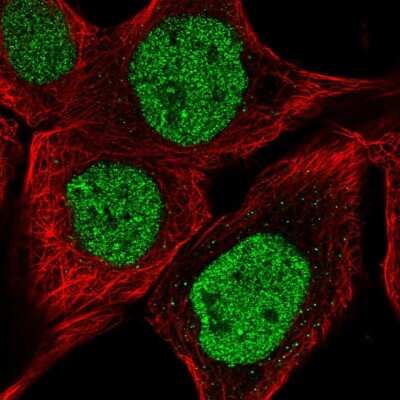 Immunocytochemistry/Immunofluorescence: DNAJB6 Antibody [NBP2-49286] - Immunofluorescent staining of human cell line A-431 shows localization to nucleoplasm.