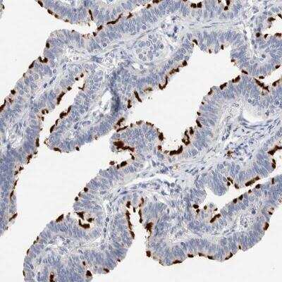 Immunohistochemistry: DNAJB6 Antibody [NBP1-82624] - Immunohistochemical staining of human fallopian tube shows distinct positivity in ciliated cells.