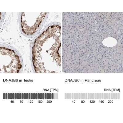 <b>Orthogonal Strategies Validation. </b>Immunohistochemistry-Paraffin: DNAJB6 Antibody [NBP1-82624] - Staining in human testis and pancreas tissues using anti-DNAJB6 antibody. Corresponding DNAJB6 RNA-seq data are presented for the same tissues.