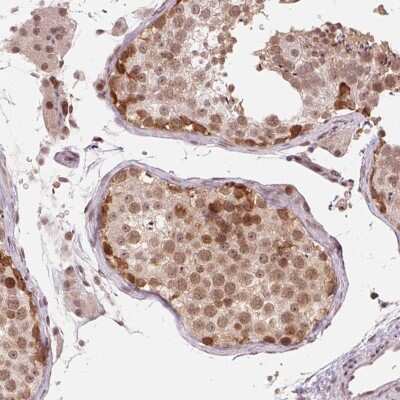 Immunohistochemistry-Paraffin: DNAJB6 Antibody [NBP2-49286] - Staining of human testis shows moderate nuclear and cytoplasmic positivity in cells in seminiferous ducts, Leydig cells.