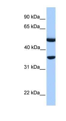 Western Blot: DNAJB6 Antibody [NBP1-54951] - Human Muscle lysate, concentration 0.2-1 ug/ml.