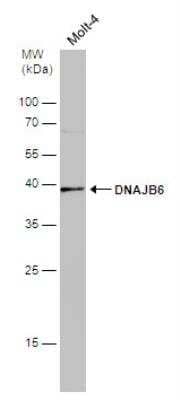 Western Blot: DNAJB6 Antibody [NBP2-16193] - Whole cell extract (30 ug) was separated by 12% SDS-PAGE, and the membrane was blotted with DNAJB6 antibody [N3C3] diluted at 1:500.