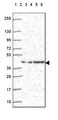 Western Blot: DNAJB6 Antibody [NBP2-49286] - Lane 1: Marker [kDa] 250, 130, 95, 72, 55, 36, 28, 17, 10Lane 2: Human cell line RT-4Lane 3: Human cell line U-251 MGLane 4: Human plasmaLane 5: Human Liver tissueLane 6: Human Tonsil tissue