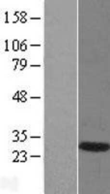 Western Blot: DNAJB6 Overexpression Lysate (Adult Normal) [NBL1-09941] Left-Empty vector transfected control cell lysate (HEK293 cell lysate); Right -Over-expression Lysate for DNAJB6.