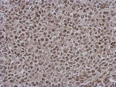 Immunohistochemistry-Paraffin: DNAJB7 Antibody [NBP2-16194] - D54 xenograft, using DNAJB7 antibody at 1:500 dilution.  Antigen Retrieval: Trilogy™ (EDTA based, pH 8.0) buffer, 15min.